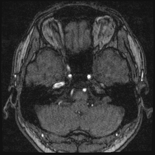 Click on the Serie image to view the images of VILLANUEVA, WILLIAM A.